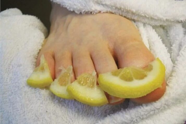 Kompresie z citrónových kvapiek - ľudový liek na hubu nechtov na nohách
